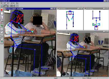 immagine trattata con il software di analisi posturale