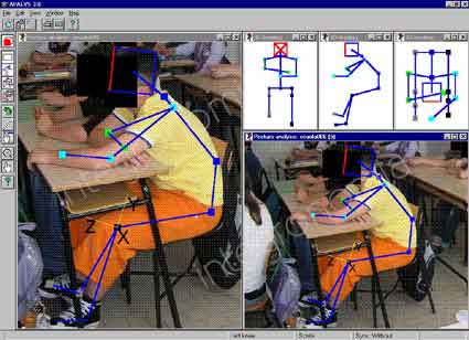 immagine trattata con il software di analisi posturale